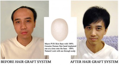 andy wang before after